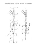 INTRODUCER FOR A SIDE BRANCH DEVICE diagram and image