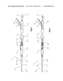 INTRODUCER FOR A SIDE BRANCH DEVICE diagram and image