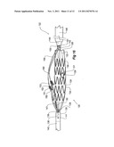 INTRODUCER FOR A SIDE BRANCH DEVICE diagram and image