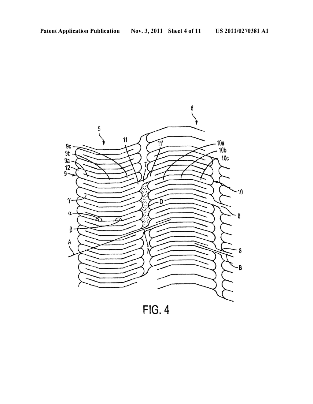 METHODS AND APPARATUS FOR STENTING COMPRISING ENHANCED EMBOLIC PROTECTION     COUPLED WITH IMPROVED PROTECTIONS AGAINST RESTENOSIS AND THROMBUS     FORMATION - diagram, schematic, and image 05