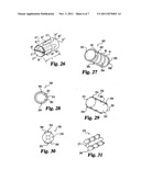 SYNTHETIC REINFORCED INTERBODY FUSION IMPLANTS diagram and image