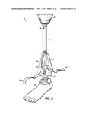 PROSTHETIC SYSTEM AND METHOD UTILIZING MICROPROCESSOR-CONTROLLED ELECTRIC     VACUUM PUMP diagram and image