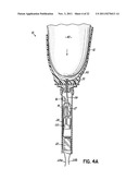 PROSTHETIC SYSTEM AND METHOD UTILIZING MICROPROCESSOR-CONTROLLED ELECTRIC     VACUUM PUMP diagram and image