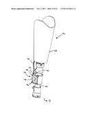 PROSTHETIC SYSTEM AND METHOD UTILIZING MICROPROCESSOR-CONTROLLED ELECTRIC     VACUUM PUMP diagram and image