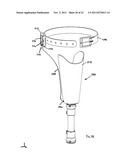 PROSTHETIC SYSTEM AND METHOD UTILIZING MICROPROCESSOR-CONTROLLED ELECTRIC     VACUUM PUMP diagram and image