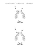 INDIVIDUALIZED ORTHODONTIC TREATMENT INDEX diagram and image