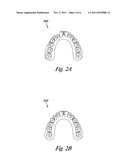 INDIVIDUALIZED ORTHODONTIC TREATMENT INDEX diagram and image