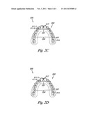 INDIVIDUALIZED ORTHODONTIC TREATMENT INDEX diagram and image