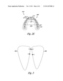 INDIVIDUALIZED ORTHODONTIC TREATMENT INDEX diagram and image