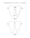 INDIVIDUALIZED ORTHODONTIC TREATMENT INDEX diagram and image