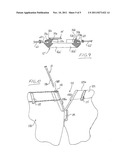 Garment, Garment Accessory, Garment Belt and Combinations of Same diagram and image