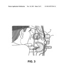 Selective Fiber Optic Sight System diagram and image