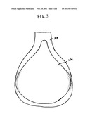 REMOVABLE TRACTION CONTROL SYSTEM, METHOD AND APPARATUS FOR EQUESTRIAN AND     OTHER MOUNTABLE SPORTS RIDING EQUIPMENT diagram and image