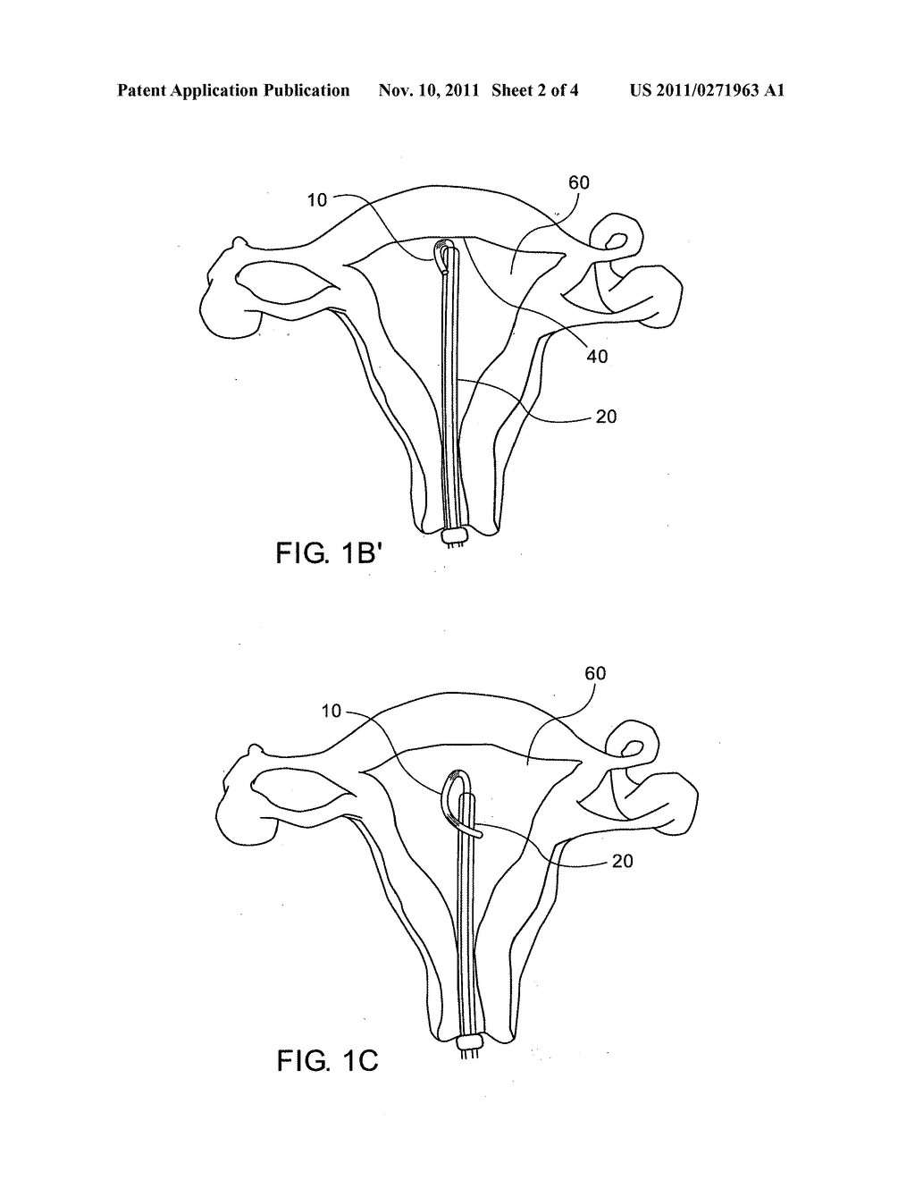 NOVEL INTRA UTERINE DEVICE - diagram, schematic, and image 03