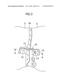 REINFORCING STRUCTURE FOR VEHICLE BODY FRONT PART diagram and image