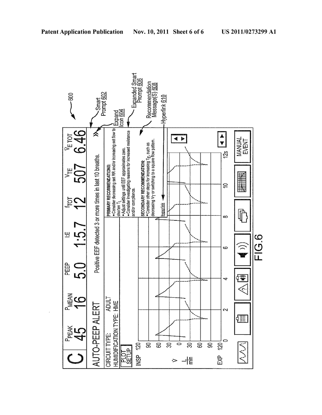 Ventilator-Initiated Prompt Regarding Auto-PEEP Detection During Volume     Ventilation Of Non-Triggering Patient - diagram, schematic, and image 07