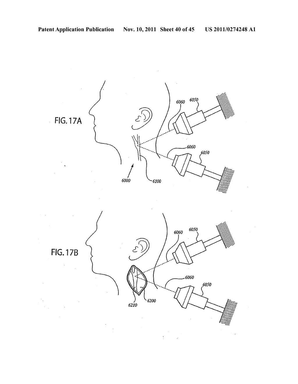 ORTHOVOLTAGE RADIOTHERAPY - diagram, schematic, and image 41