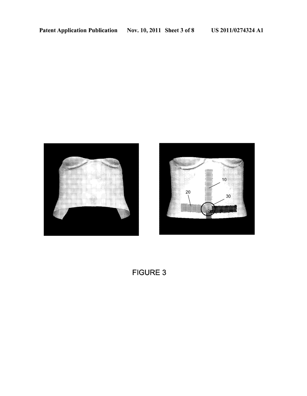 SYSTEM AND METHOD FOR ABDOMINAL SURFACE MATCHING USING PSEUDO-FEATURES - diagram, schematic, and image 04