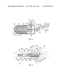 PITCH CONTROL MECHANISM diagram and image