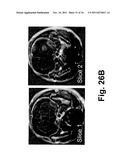 Antibody-Targeted Carrier For Contrast Agents diagram and image