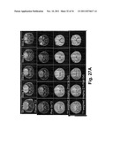 Antibody-Targeted Carrier For Contrast Agents diagram and image