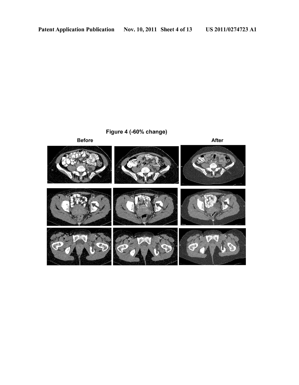 CANCER IMMUNOTHERAPY AND METHOD OF TREATMENT - diagram, schematic, and image 05