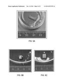 IMPLANTABLE COMPOSITIONS FOR REPAIRING OSTEOCHONDRAL DEFECTS diagram and image