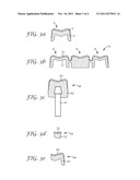 METHOD OF PRODUCING A DENTAL RESTORATION, DENTAL RESTORATION AND USE     THEREOF diagram and image