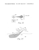 COMMUNICATION SYSTEM WITH MICRORADIOS diagram and image