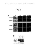 METHODS FOR TREATING NEOPLASIA AND FOR IDENTIFYING COMPOSITIONS USEFUL IN     SUCH THERAPY diagram and image