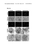 Thioxanthone-Based Autophagy Inhibitor Therapies to Treat Cancer diagram and image