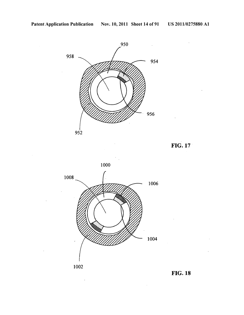 Lumen-traveling biological interface device and method of use - diagram, schematic, and image 16