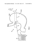 SELF-REGULATING GASTRIC BAND WITH PRESSURE DATA PROCESSING diagram and image