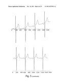 METHOD OF NONINVASIVE ELECTROPHYSIOLOGICAL STUDY OF THE HEART diagram and image