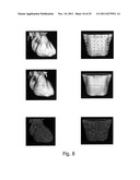 METHOD OF NONINVASIVE ELECTROPHYSIOLOGICAL STUDY OF THE HEART diagram and image