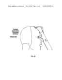 GOLDMANN APPLANATION TONOMETER, BIOMICROSCOPY DEVICE AND RELATED METHODS diagram and image