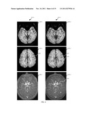 Susceptibility Weighted Magnetic Resonance Imaging Of Venous Vasculature diagram and image