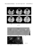 Susceptibility Weighted Magnetic Resonance Imaging Of Venous Vasculature diagram and image