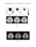 Susceptibility Weighted Magnetic Resonance Imaging Of Venous Vasculature diagram and image