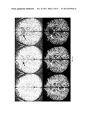 Susceptibility Weighted Magnetic Resonance Imaging Of Venous Vasculature diagram and image