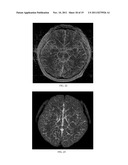 Susceptibility Weighted Magnetic Resonance Imaging Of Venous Vasculature diagram and image