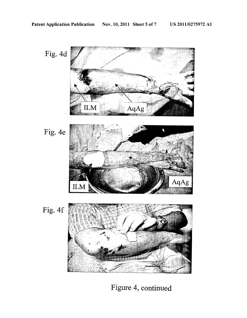 INTERFACE LAYER WOUND DRESSING - diagram, schematic, and image 06