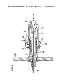 ANESTHETIC COMPOUND NEEDLE diagram and image