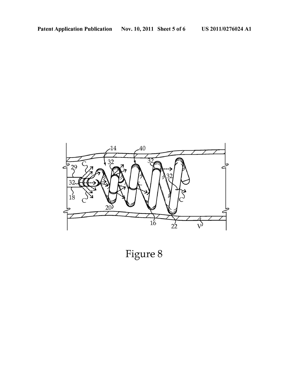 Treatment Fluid Delivery Method, And Turbulator For Promoting Uptake Of A     Treatment Agent - diagram, schematic, and image 06