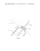 NEEDLE BASED HELICAL COIL SAFETY DEVICE diagram and image