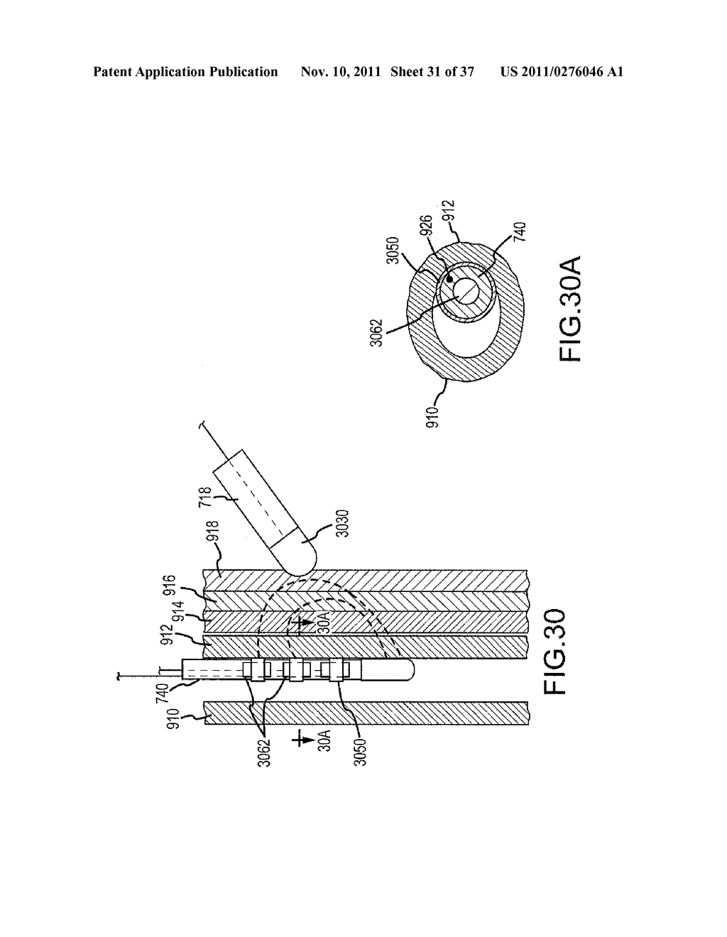 Monitoring, Managing and/or Protecting System and Method for Non-Targeted     Tissue - diagram, schematic, and image 32