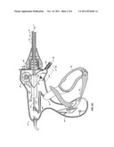 Pinion Blade Drive Mechanism for a Laparoscopic Vessel Dissector diagram and image