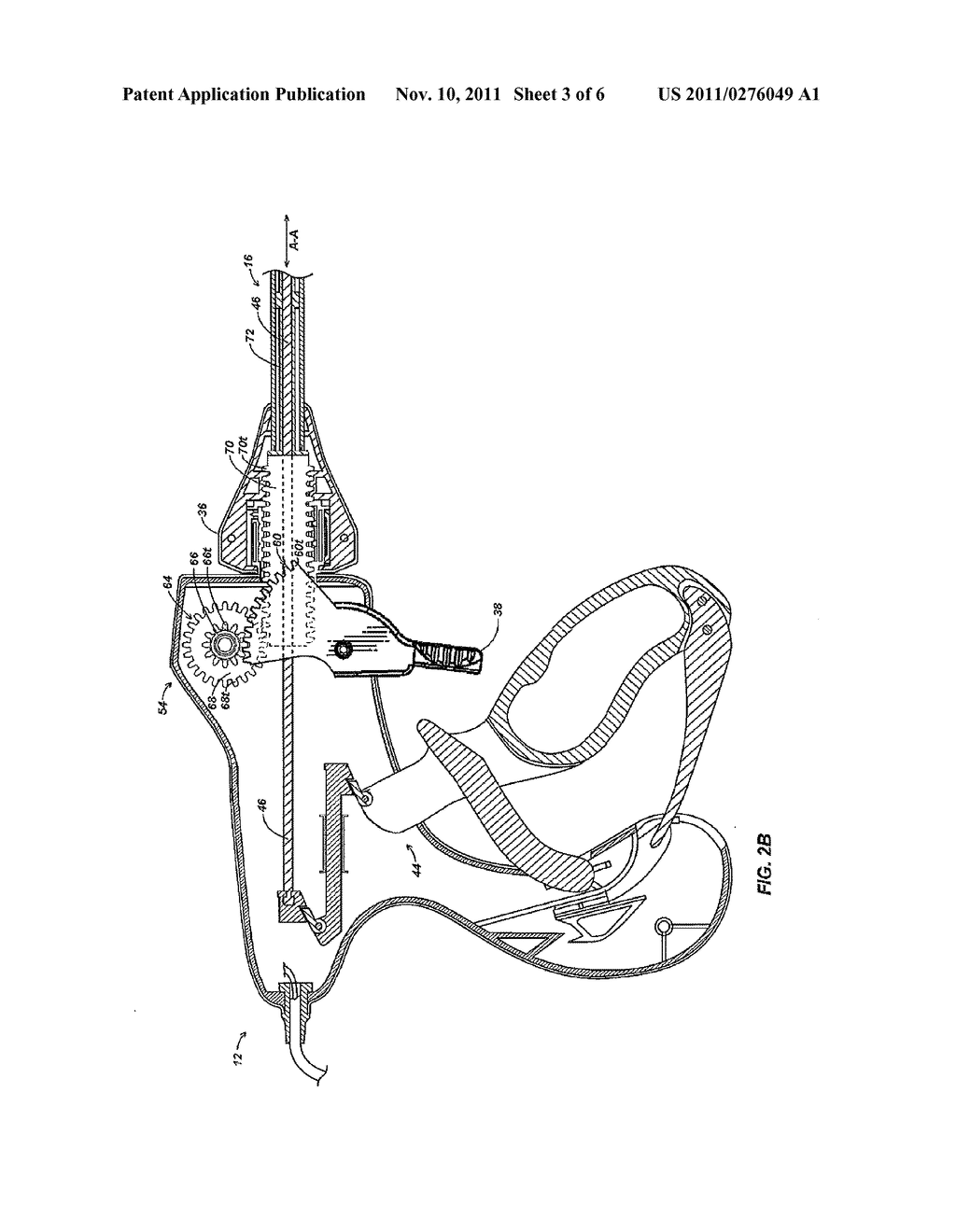 Pinion Blade Drive Mechanism for a Laparoscopic Vessel Dissector - diagram, schematic, and image 04