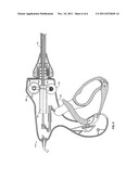 Pinion Blade Drive Mechanism for a Laparoscopic Vessel Dissector diagram and image