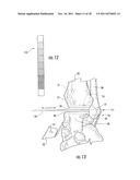 Method of Preparing an Ankle Joint for Replacement, Joint Prosthesis, and     Cutting Alignment Apparatus for Use in Performing an Arthroplasty     Procedure diagram and image